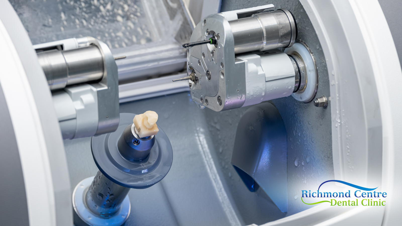 A machine is cutting a tooth in a dental clinic.